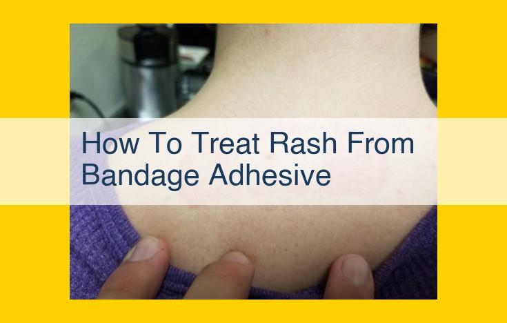 Bandage Rash: Symptoms, Treatment, and Prevention Tips