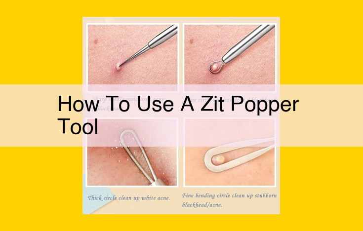 Safe and Effective Zit Removal: A Comprehensive Guide to Using a Zit Popper Tool