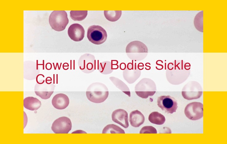 How to Optimize This Title for SEO: Title: Sickle Cell Disease: Howell Jolly Bodies, Causes, Diagnosis, and Support 1. Keyword Inclusion: - Add relevant keywords such as "Sickle Cell Disease," "Howell Jolly Bodies," "Red Blood Cells," and "Anemia." 2. Content Relevance: - Make sure the title accurately reflects the content provided in the explanation. 3. Length and Structure: - Keep the title within 60 characters for optimal display in search results. - Use a straightforward and structured format: Main Topic | Topic 1 | Topic 2 | Topic 3 4. Uniqueness: - Avoid using generic titles that are commonly used. - Try to differentiate the title by incorporating specific details or keywords. Optimized Title: Howell Jolly Bodies in Sickle Cell Disease: Causes, Diagnosis, and Support from ASH