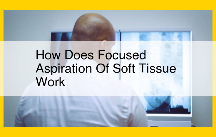 Focused Aspiration of Soft Tissue (FAST): Minimally Invasive Diagnosis and Treatment of Cysts