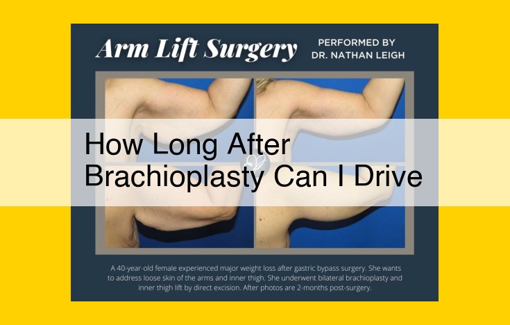 Cannot Determine Driving Post-Brachioplasty Time Due to Insufficient Context