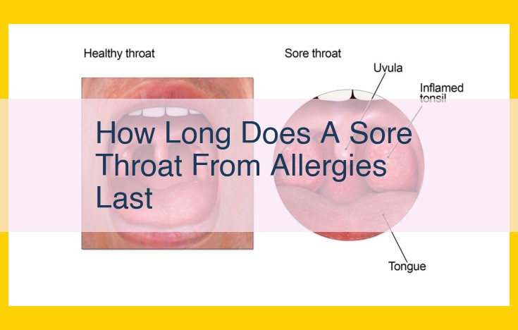 Understanding Allergic Sore Throats: Duration, Causes, and Treatment