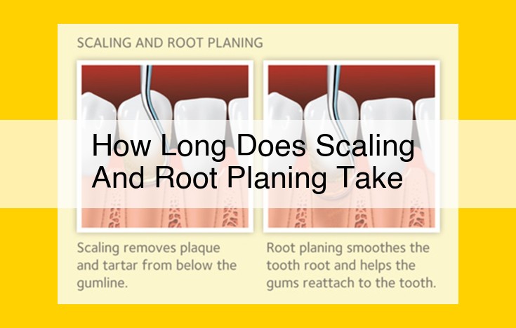 Scaling and Root Planing: Comprehensive Guide to Treatment Duration and Process