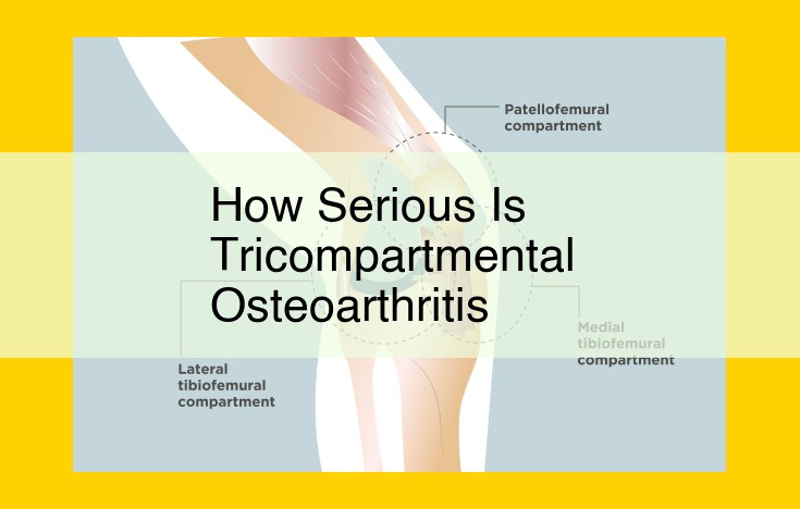 Tricompartmental Osteoarthritis: Severe Knee Pain, Stiffness, and Disability