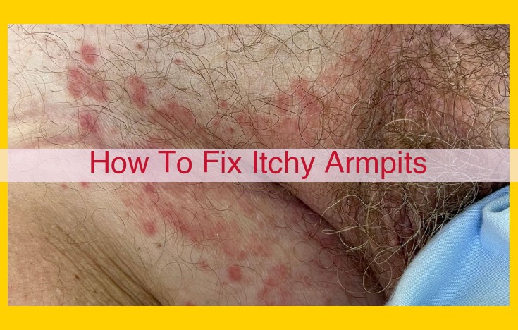 Intertrigo: Itchy Armpits - Causes, Treatment, Prevention, and When to Seek Medical Help