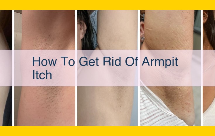 Effective Armpit Itch Relief: Causes, Treatment, and Prevention