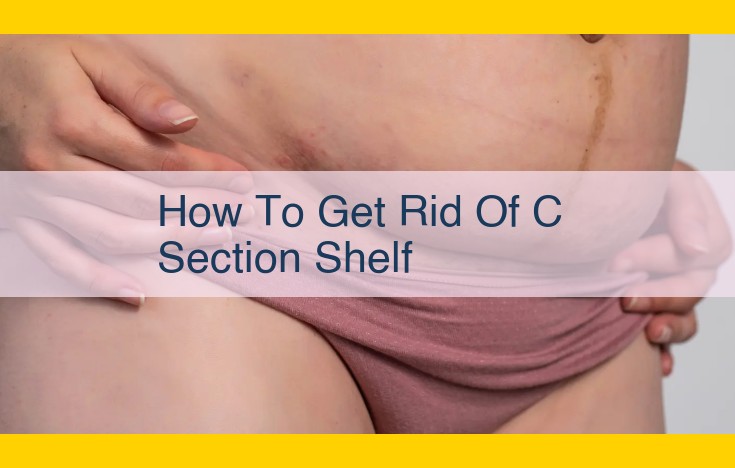 Eliminate Your C-Section Shelf: Effective Body Contouring Solutions