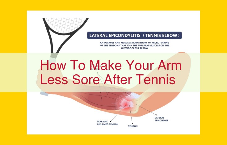 Combat Arm Soreness from Tennis: A Comprehensive Guide to Stretching, Strengthening, and Recovery