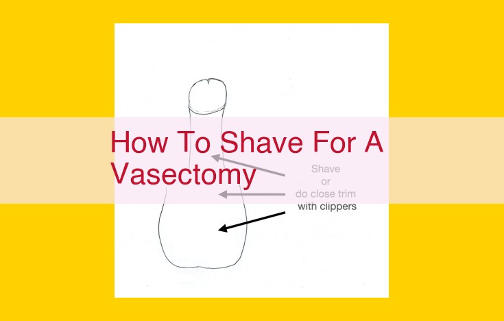 Vasectomy Procedure: Medical Personnel, Equipment, and Facilities Involved