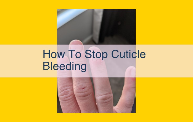 Effective Home Treatments for Cuticle Bleeding: Pressure, Elevation, and When to Seek Medical Attention