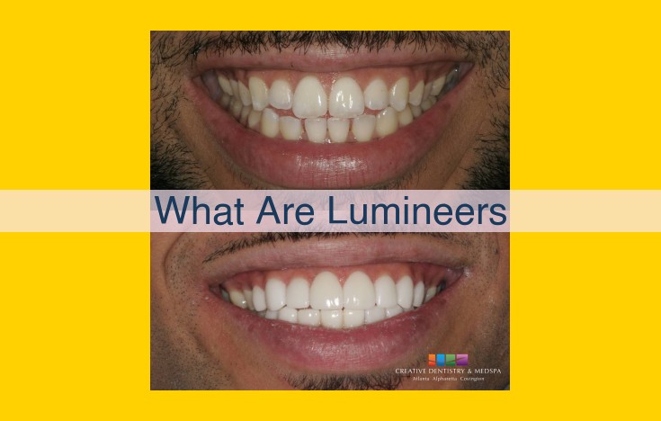 Lumineers: The Ultimate Guide to Ultra-Thin Porcelain Veneers for a Radiant Smile