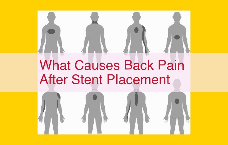 Back Pain After Stent Placement: Causes and Treatment Options