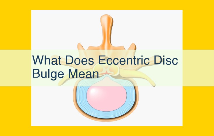 Eccentric Disc Bulge: Causes, Symptoms, and Treatment Options