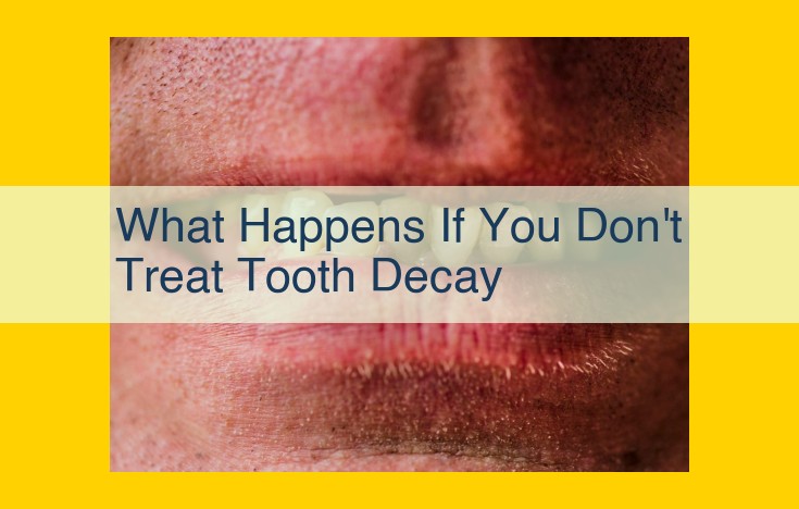 Untreated Tooth Decay: Dire Consequences and Systemic Health Risks