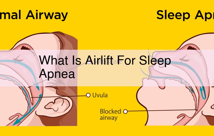 Airlift Devices: Treating Sleep Apnea | Comprehensive Guide