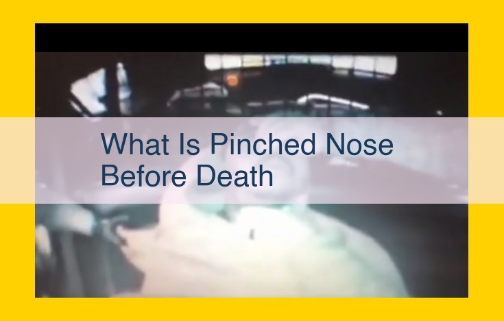 Pinched Nose Before Death: A Sign of End-of-Life Approaching