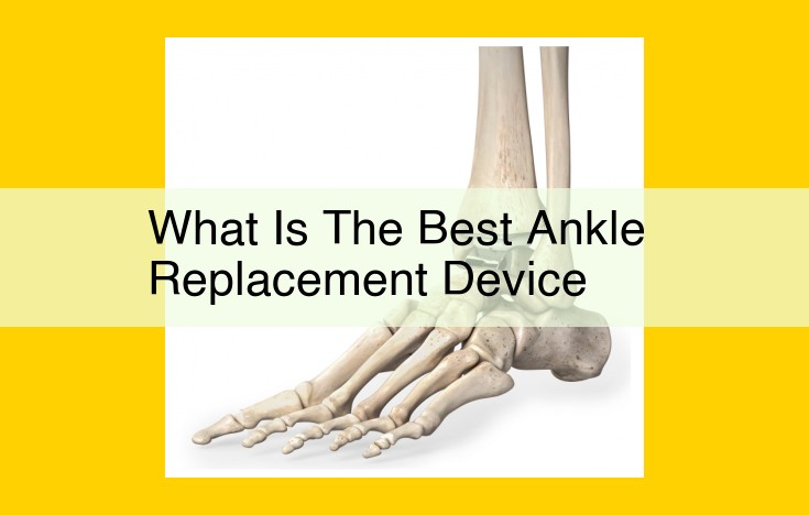 Patient-Specific Ankle Replacement Devices: Exploring Key Entities and Innovations