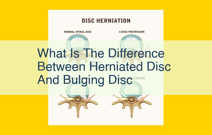 Herniated vs Bulging Disc: Understanding the Differences, Symptoms, and Treatment Options