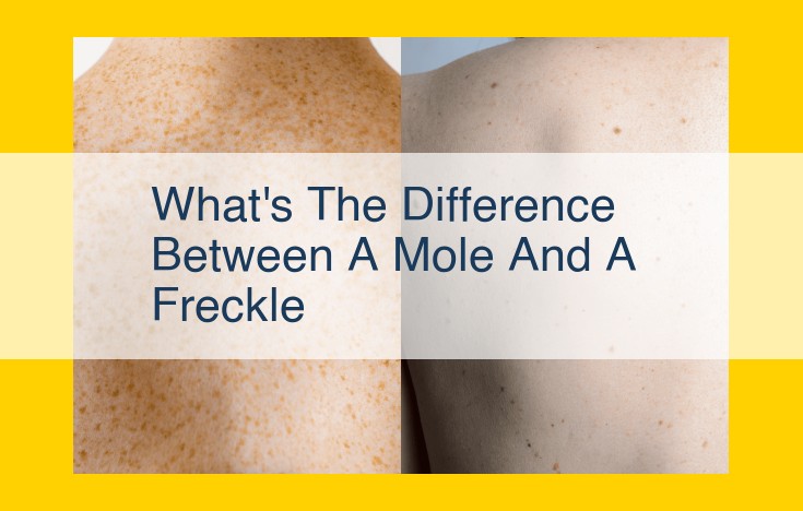 Moles and Freckles: Understand the Differences and Impacts